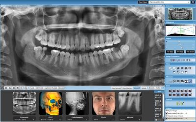 Planmeca ProMax® 2D