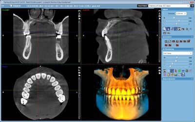 Planmeca ProMax® 3D Classic