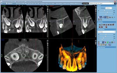 Planmeca ProMax® 3D Classic