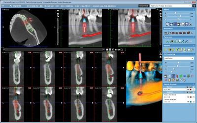 Planmeca ProMax® 3D Classic