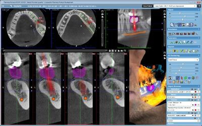 Planmeca ProMax® 3D Classic