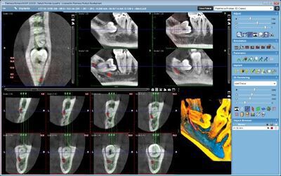 Planmeca ProMax® 3D Classic