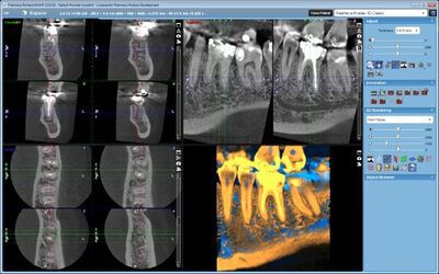 Planmeca ProMax® 3D Max