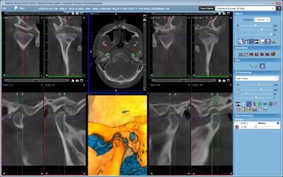 Planmeca ProMax® 3D Max