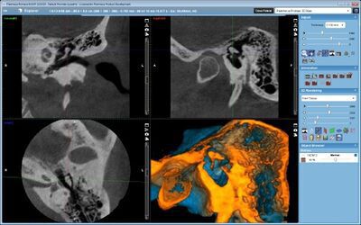 Planmeca ProMax® 3D Max