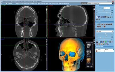 Planmeca ProMax® 3D Max