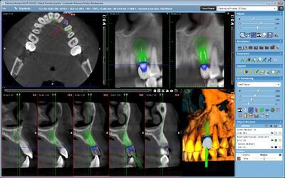 Planmeca ProMax® 3D Max