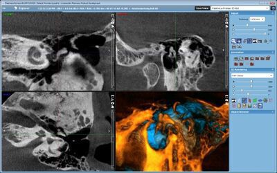 Planmeca ProMax® 3D Mid