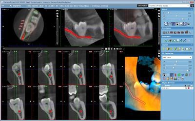 Planmeca ProMax® 3D Mid