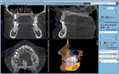 Planmeca ProMax® 3D Mid