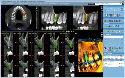 Planmeca ProMax® 3D Mid