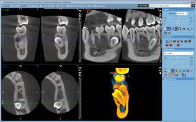 Planmeca ProMax® 3D Mid