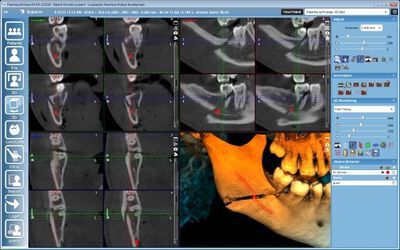 Planmeca ProMax® 3D Mid