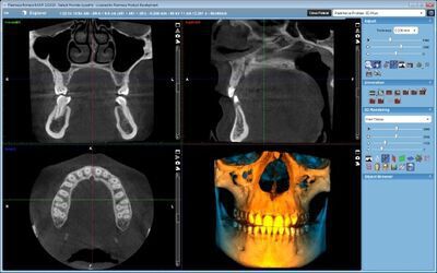 Planmeca ProMax® 3D Plus