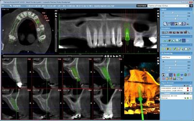 Planmeca ProMax® 3D Plus