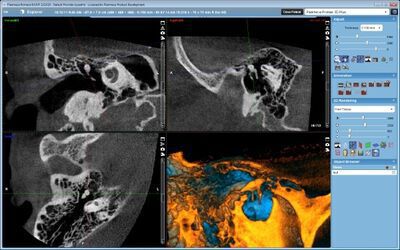 Planmeca ProMax® 3D Plus