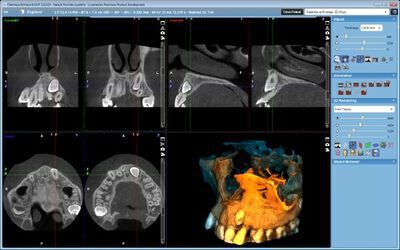 Planmeca ProMax® 3D Plus