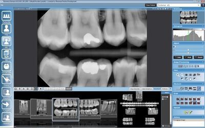 Planmeca ProSensor® HD